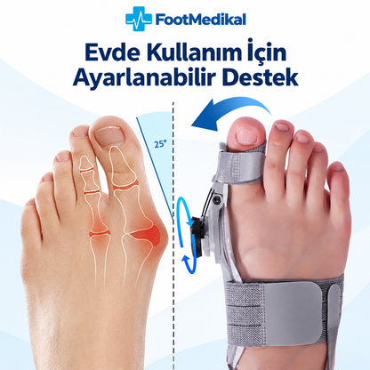 Foot Medikal™ Ayak Ateli